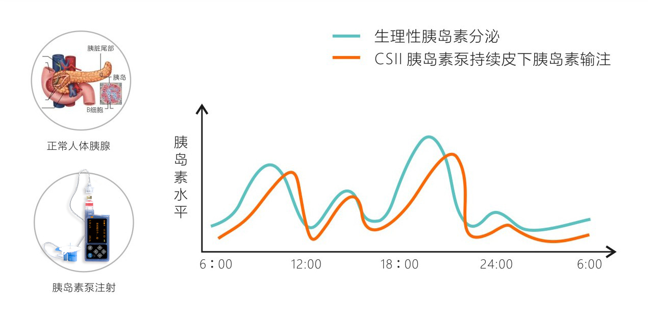 输注对比图3.jpg